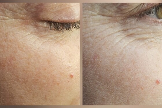 Fountain of Youth - photo 5
